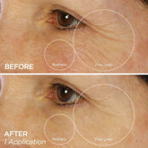BeautyBio Bright Eyes Collagen-Infused Brightening Colloidal Silver Eye Masks